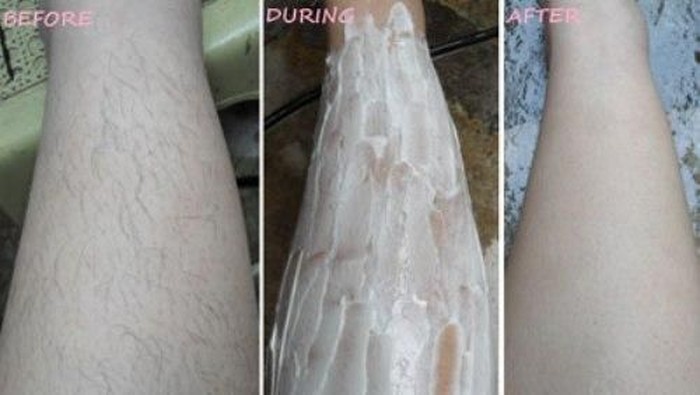 Cara Menghilangkan Bulu Kaki Dengan Krim