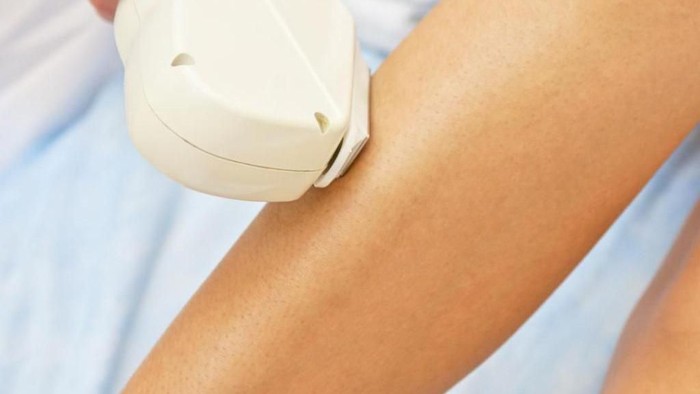 Tips Cara Menghilangkan Bulu di Badan