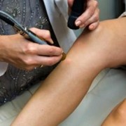 Cara Menghilangkan Bulu Kemaluan Dengan Laser