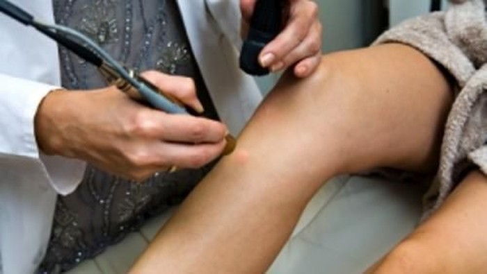 Cara Menghilangkan Bulu Kemaluan Dengan Laser