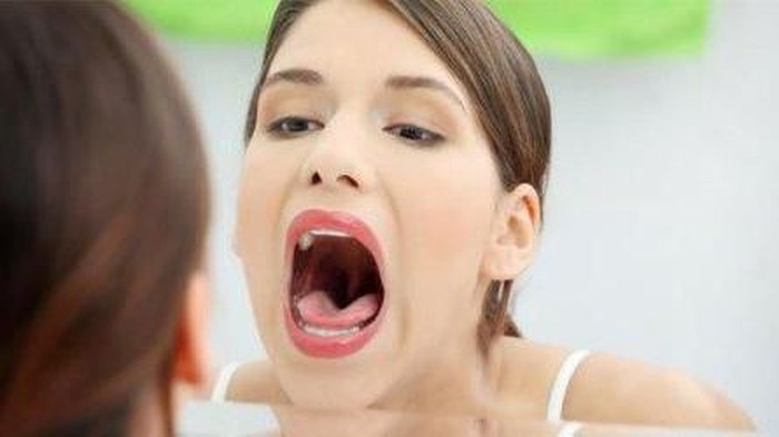 Mengatasi Bau Mulut Pada Gigi Berlubang Secara Alami