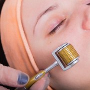 Ladies, Dermaroller seampuh itu ya untuk menghilangkan bekas jerawat dan bopeng? Sakit ga?