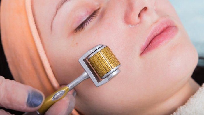 Ladies, Dermaroller seampuh itu ya untuk menghilangkan bekas jerawat dan bopeng? Sakit ga? Ladies, Dermaroller seampuh itu ya untuk menghilangkan bekas jerawat dan bopeng? Sakit ga?