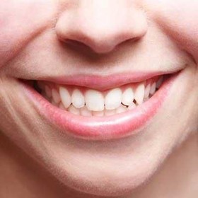 Tips Saat Melakukan Cabut Gigi Geraham