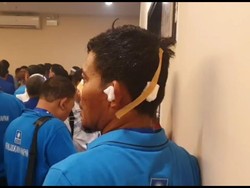 Penampakan Korban Kongres PAN: Kepala Bocor, Kuping Berdarah