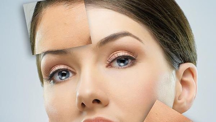 Kenali Efek Samping Bahan Obat Jerawat yang Perlu Diperhatikan