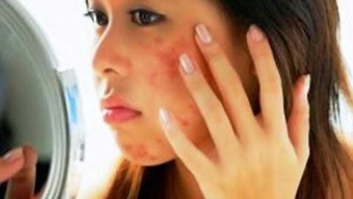 Atasi Alergi Make Up Dengan Cara Ini
