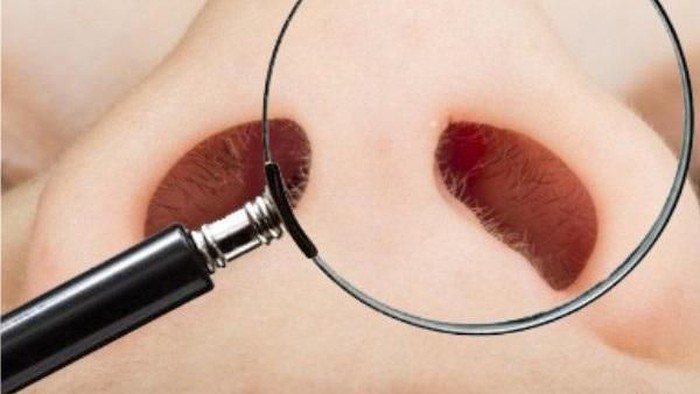 Ini Resiko Cara Menghilangkan Bulu Hidung Dengan Dicabut