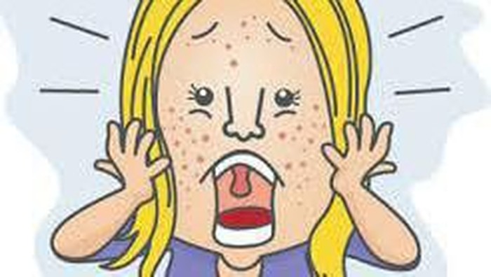 Mengenal Penyebab Munculnya Jerawat Pasir