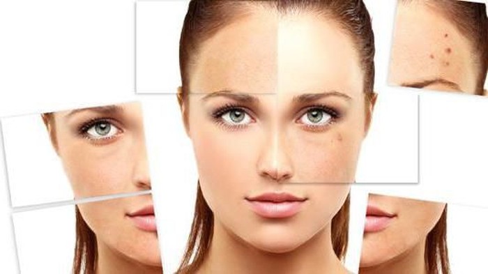 Cara Mengatasi Bekas Jerawat