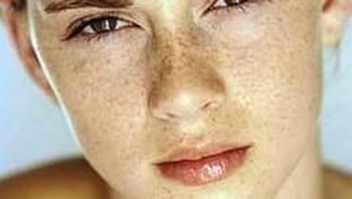 Kebiasaan yang Dapat Mencegah Flek Hitam