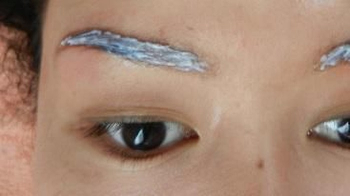 Perawatan Kulit Sebelum dan Sesudah Laser Hair Removal