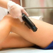Rekomendasi Salon Penghilang Bulu untuk IPL
