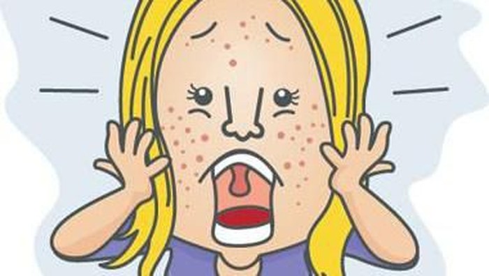 Yang Harus Diketahui Mengenai Pori-Pori Besar