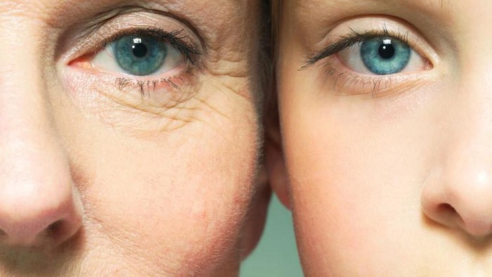 Kenali Berbagai Penyebab Kulit Keriput