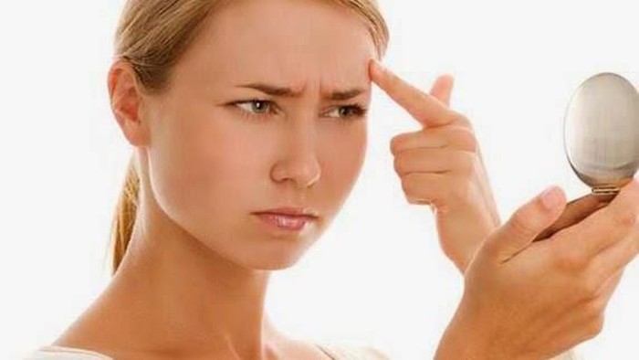 3 Cara Menghilangkan Jerawat Dengan Bahan Alami
