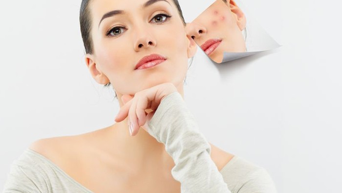 Makanan yang Patut Dicoba Saat Berjerawat