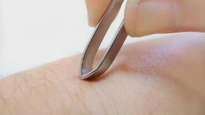 Persiapan yang Tepat Sebelum Laser Hair Removal