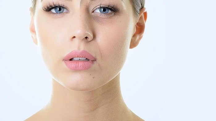 5 Langkah Cepat Singkirkan Pori Membesar