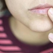 Apa penyebab bibir hitam?