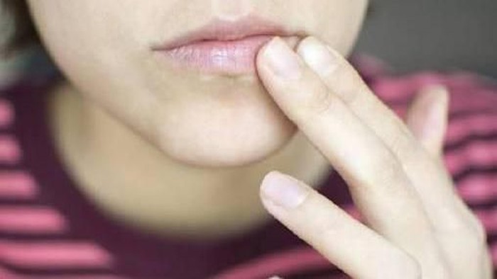Apa penyebab bibir hitam? Apa penyebab bibir hitam?