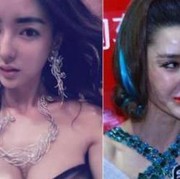 Dulu Cantik, Tapi Sekarang Begini Tampilan Wajah yang Gagal Operasi Plastik!