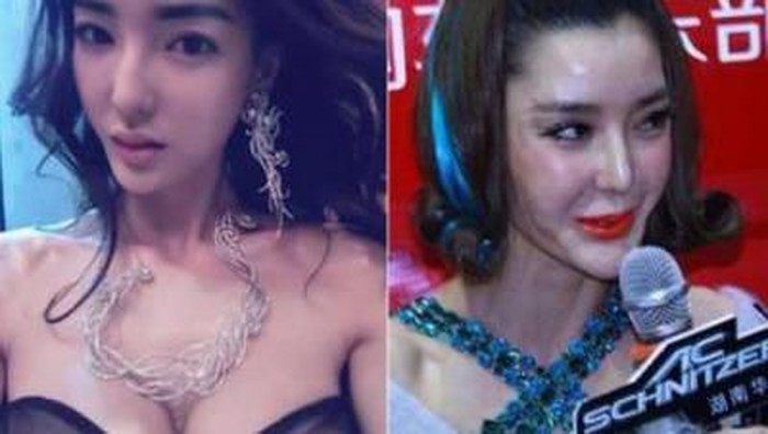 Dulu Cantik, Tapi Sekarang Begini Tampilan Wajah yang Gagal Operasi Plastik! Dulu Cantik, Tapi Sekarang Begini Tampilan Wajah yang Gagal Operasi Plastik!