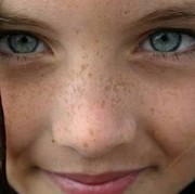 Bagaimana cara menghilangkan flek hitam?