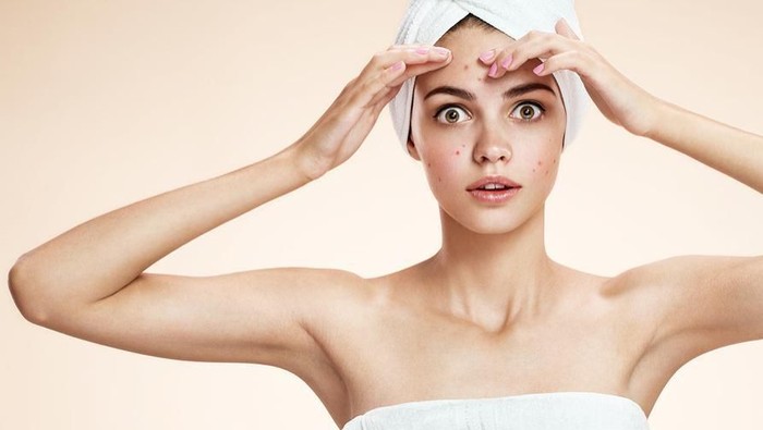 Terkenal Ampuh, 4 Obat Jerawat Di Apotek Ini Jadi Rekomendasi!