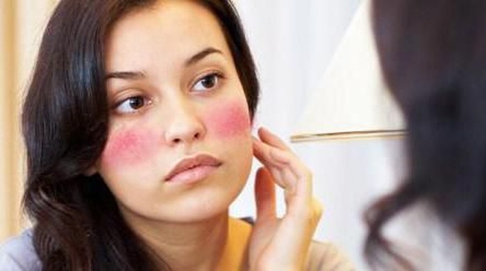 Alami 7 Tanda Ini? Waspada Kamu Alergi Terhadap Produk Kecantikan!