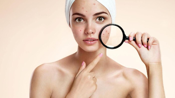 Help me ladies! Berapa Lama Sih Biasanya Proses Kulit Purging Berlangsung? Help me ladies! Berapa Lama Sih Biasanya Proses Kulit Purging Berlangsung?
