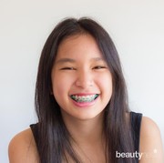 Apa sich rasanya pakai behel? Sakit tapi beneran bisa bikin wajah tirus ya?