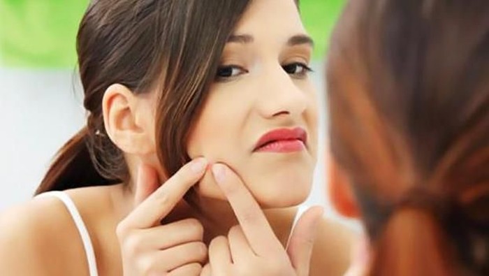 Bisa Menimbulkan Kematian, Inilah Bahaya Memencet Jerawat Batu pada Wajah!