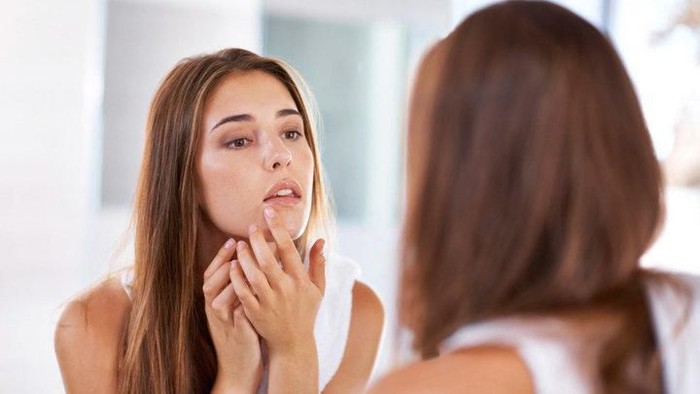 Jangan Bete! Ini Tips Singkat Mengatasi Pori-Pori Besar Bekas Jerawat Yang Membandel!