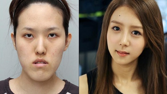 Bikin Melongo! Ini Dia 5 Operasi Plastik dengan Hasil Paling Sempurna!