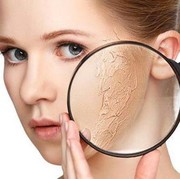 [FORUM] Aduh kulitku kering banget!