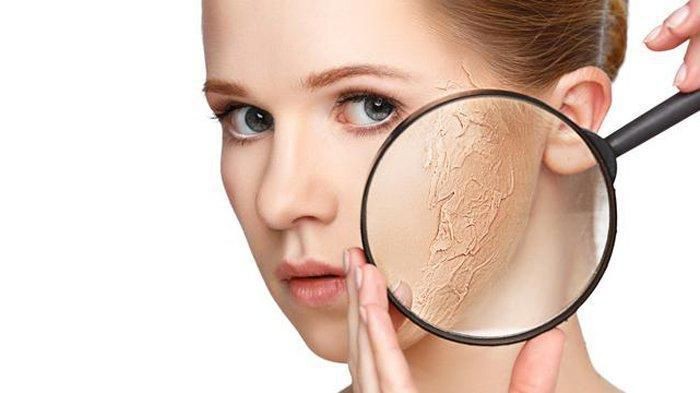 [FORUM] Aduh kulitku kering banget!