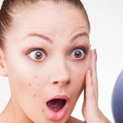 [FORUM] Break Out gara-gara skin care nih.......