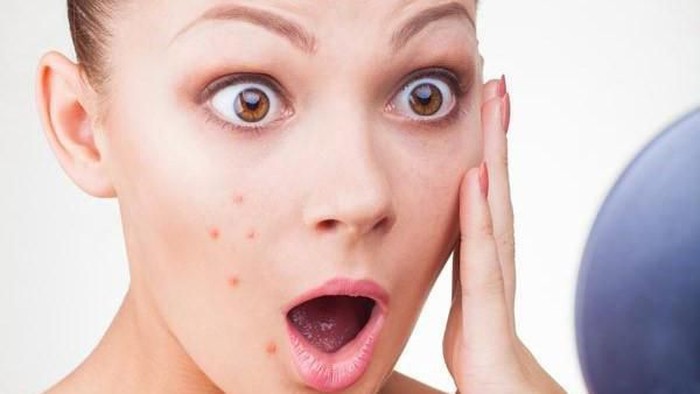 [FORUM] Break Out gara-gara skin care nih.......