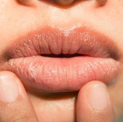 Wow, Ternyata Inilah Fakta di Balik Munculnya Bibir Kering Hingga Pecah-pecah