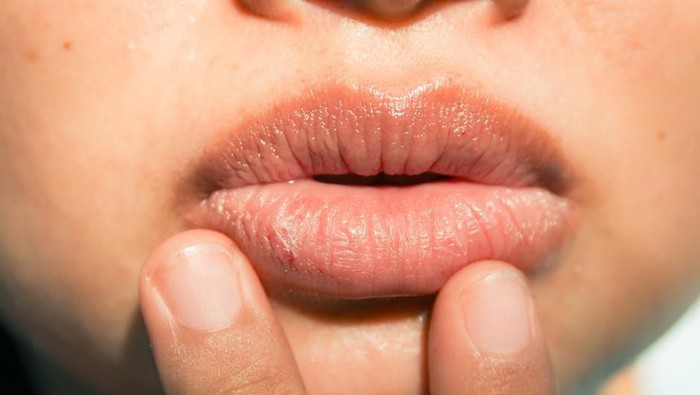 Wow, Ternyata Inilah Fakta di Balik Munculnya Bibir Kering Hingga Pecah-pecah