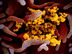 Mutasi Baru Virus Corona, Menular 10 Kali Lebih Cepat dari COVID-19