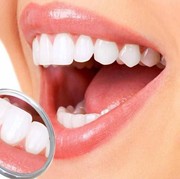 [FORUM] Mutihin gigi hukumnya apa sih..?