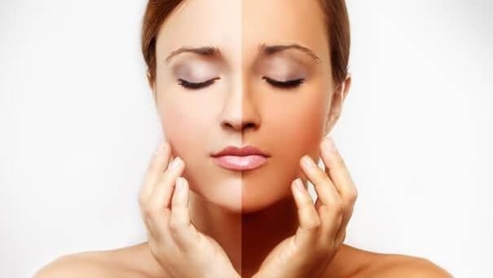 Belang Setelah Liburan, Bahan-bahan Alami Ini Dijamin Ampuh Memutihkan Kulit Kamu Kembali