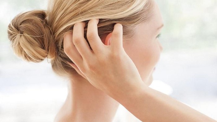 Dijamin Hilang Seketika, Cara Menghilangkan Ketombe Seperti Ini Harus Kamu Coba Sekarang Juga!