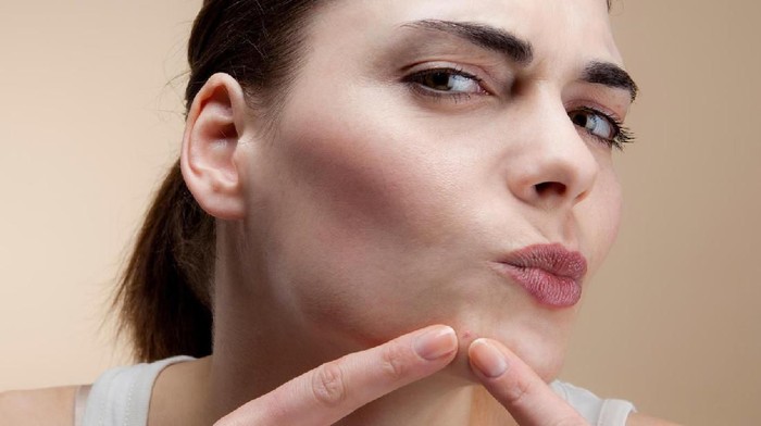 Wow, 5 Cara Ini Sukses Menghilangkan Bekas Jerawat Cepat Dalam 1 Hari!