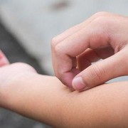 [FORUM] kalo udah pernah kena cacar katanya gak bakal kena lagi, beneran gak sih....