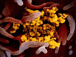 Kasus Corona Global Tembus 22 Juta, WHO Sebut Herd Immunity Masih Jauh