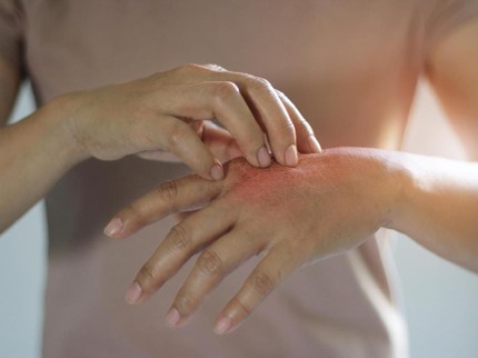 Tubuh Gadis Cilik Membatu Setelah Alami Kulit Bersisik dan Melepuh Parah