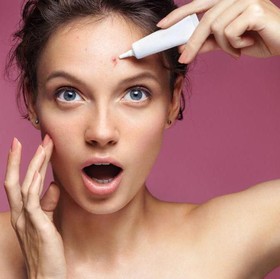 Bingung Menghadapi Jerawat Batu? Coba 5 Cara Alami Berikut!